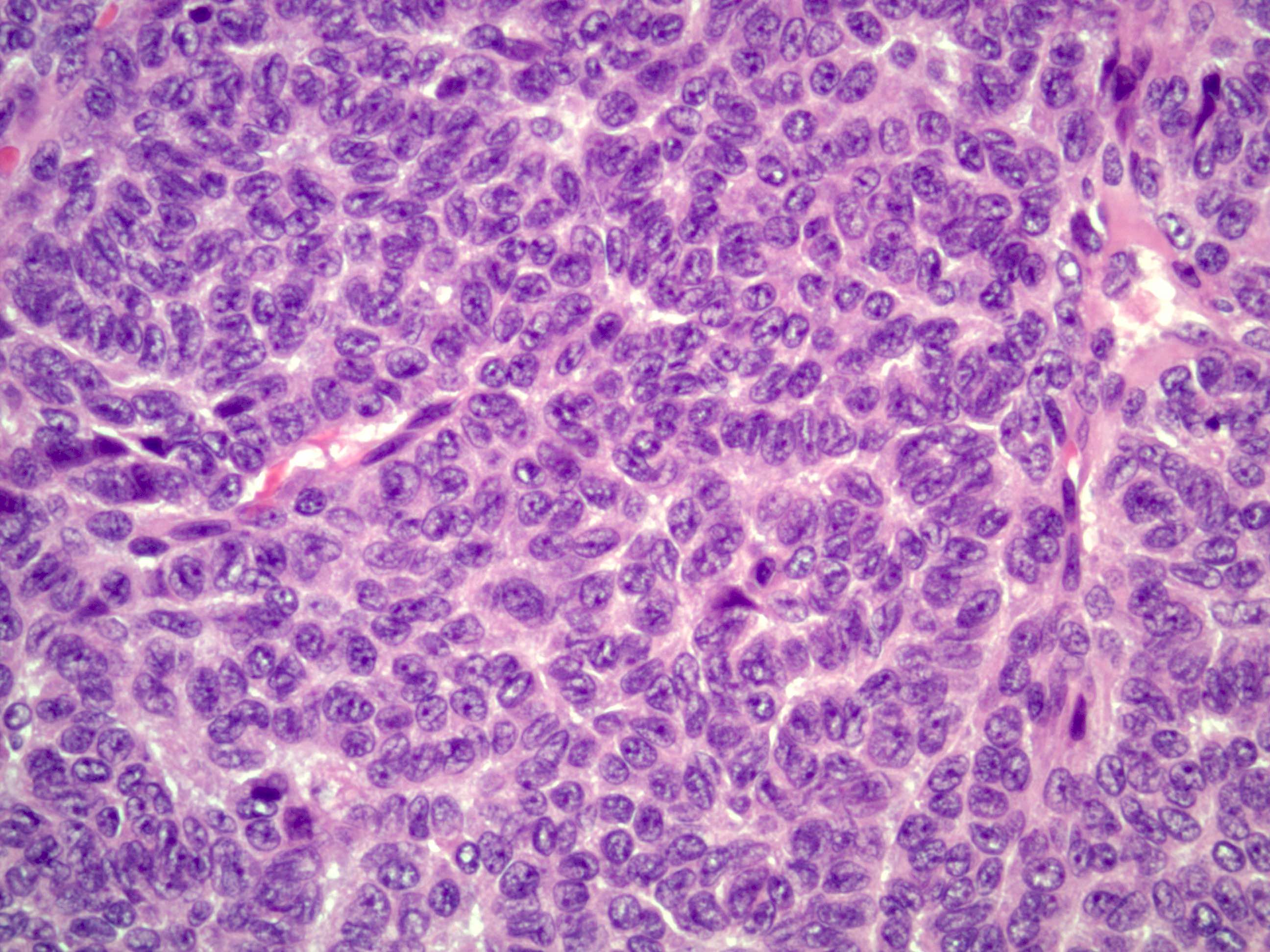 granulosa theca cell tumor mare